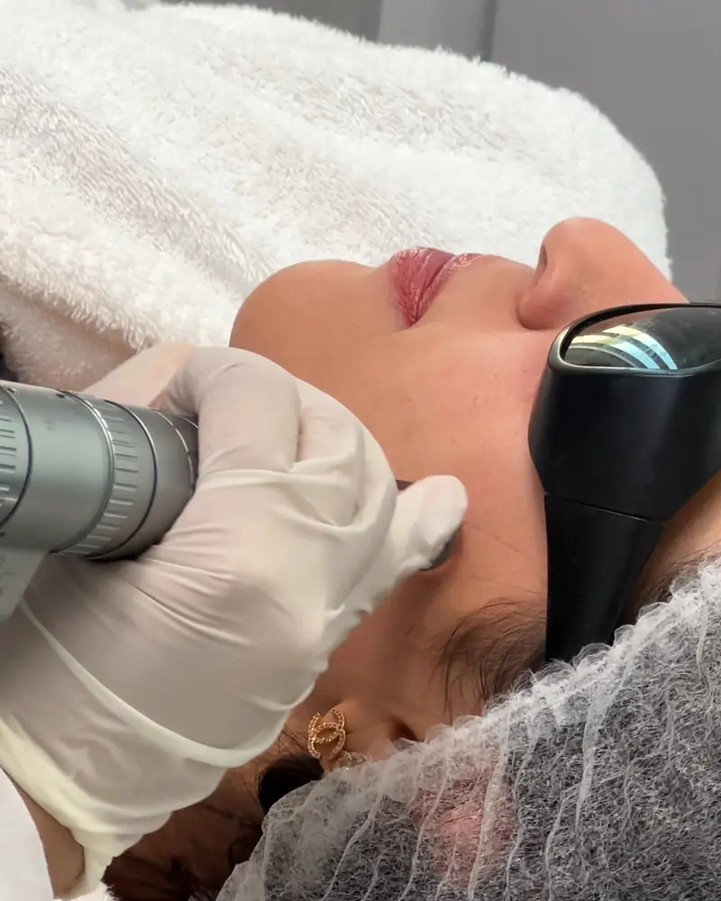 laser treatment at Dermabloom Medical Centre in Mirdif Dubai